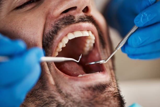 Best Emergency Root Canal Treatment in Uintah, UT